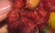 医生称车厘子果蝇的幼虫水洗不掉 需多流程进行清理 ！