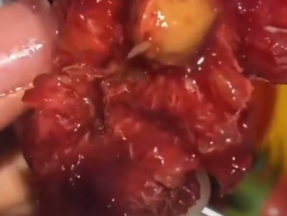医生称车厘子果蝇的幼虫水洗不掉 需多流程进行清理 ！