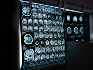 异地就医不用带片子！医学影像开始实现全国“漫游” !