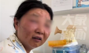 怕孩子被传染流感：新手宝妈频繁洗手致过敏、脸变形 !