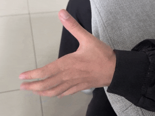 高中生左手莫名发抖半年确诊平山病：长期保持错误坐姿 !