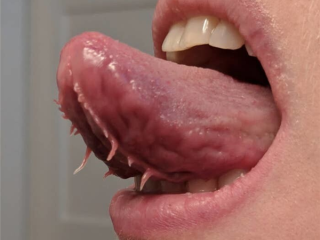 男子舌头天生异常：下面竟然长着两条“流苏”！ 