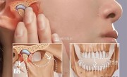 00后女生一觉醒来无法张嘴：确诊“T M D” ！