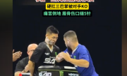 中国通背拳传人赵鸿刚参加世界职业扇耳光大赛遭KO：眉骨缝5针 本人回应：没有脑震荡 !